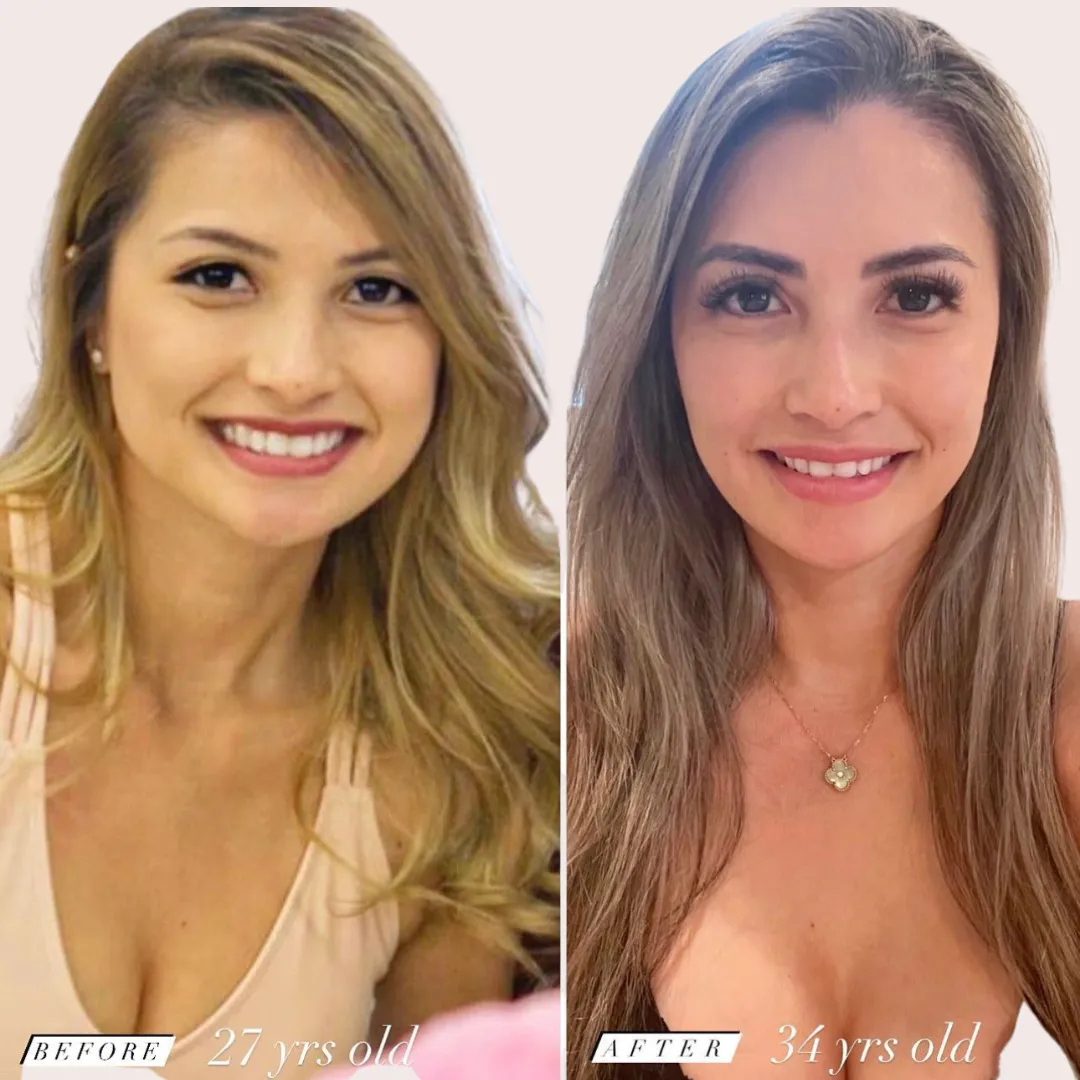 Catherine Ngo before at age 27 and after at age 34