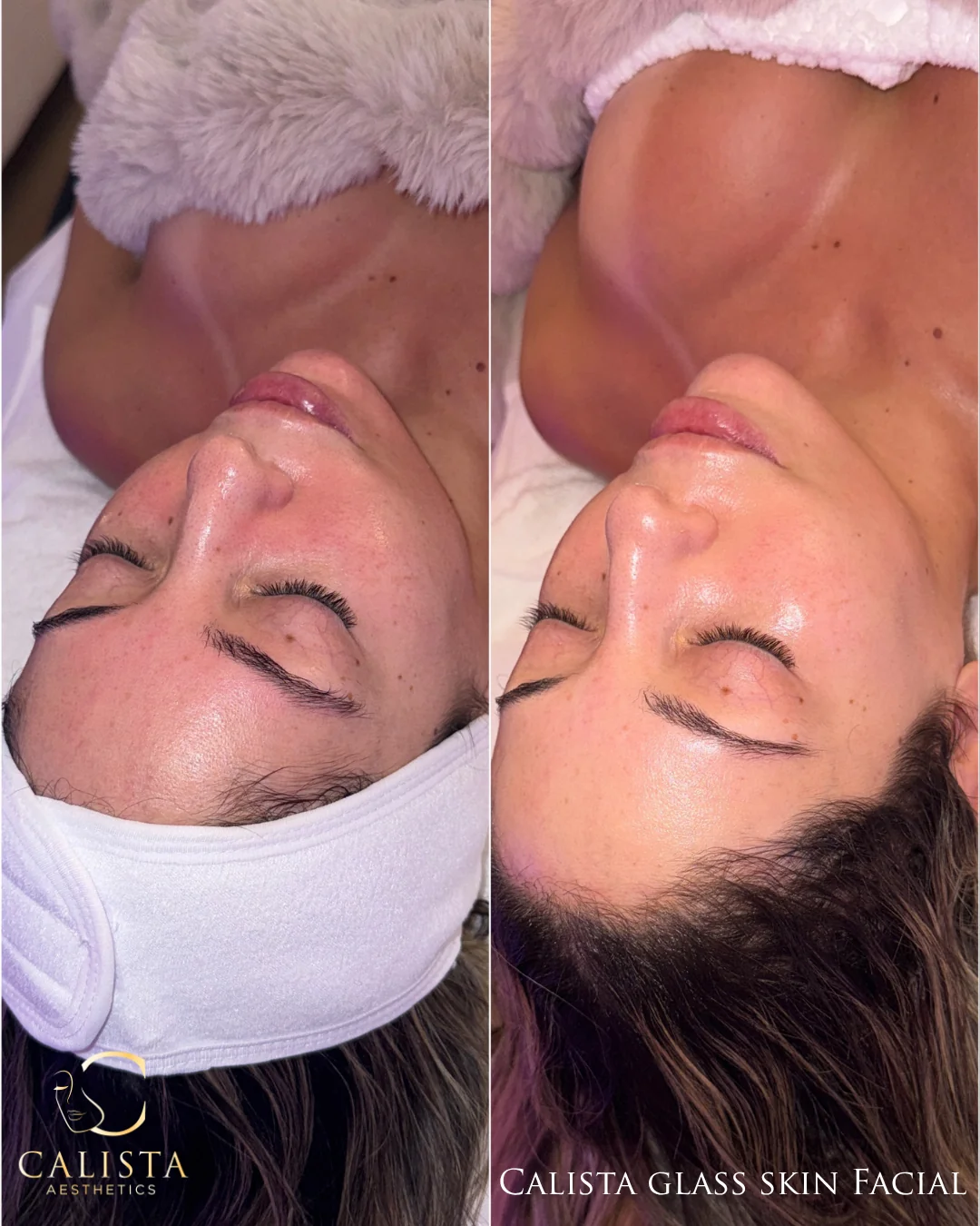 Full-face before-and-after photos of a reclined client, labeled Calista Glass Skin Facial.