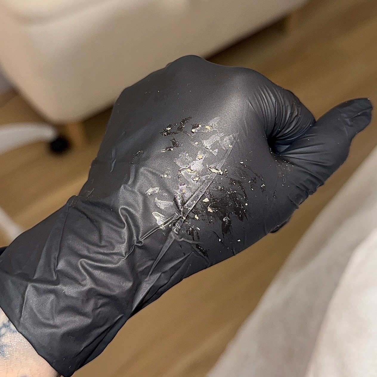 Material collected during facial extractions on a black glove